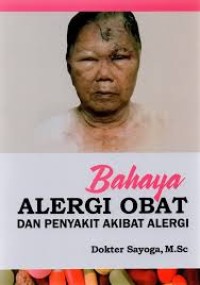 Image of Bahaya Alergi Obat dan Penyakit Akibat Alergi